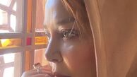 صورت آفتاب خورده بهاره رهنما + عکس
