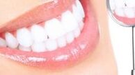 چه راه هایی برای زیباتر شدن دندان ها مناسب است؟