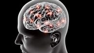 پیشگیری از آلزایمر با داروی موجود