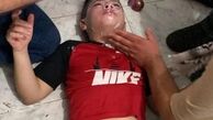 مصدوم شدن ده‌ها فلسطینی بر اثر استنشاق گاز اشک‌آور
