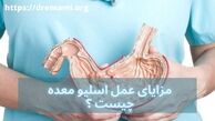 مزایای اسلیو معده چیست ؟