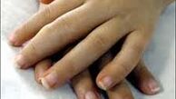 چرا انگشتان دست ورم می کند؟