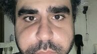 صورت ورم کرده امیر نوری + عکس