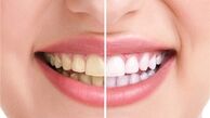 علت خونریزی لثه چیست؟