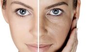  لایه برداری از پوست با طب سنتی