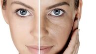 راه‌های پیشگیری از ایجاد چین و چروک صورت