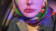 نیوشا ضیغمی با سری شکسته + عکس