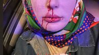 نیوشا ضیغمی با سری شکسته + عکس