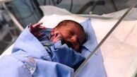 نخستین نوزاد حج امسال در کوه عرفات متولد شد