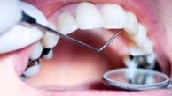 ماجرای فوت دریا دلکش ۱۲ ساله با عمل دندانپزشکی 