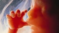 ژن موثر در ایجاد عقب‌ماندگی‌های ذهنی