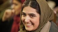 صورت زخمی باران کوثری پس از تصادف+عکس