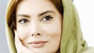 فروزنده: بعضی‌ها به‌جای جراحی زیبایی ذهنشان را درمان کنند 