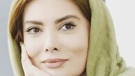 فروزنده: بعضی‌ها به‌جای جراحی زیبایی ذهنشان را درمان کنند 