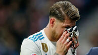 وضعیت شکستگی بینی سرجیو راموس در دربی مادرید (عکس)