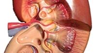 تغییر در رنگ ادرار را جدی بگیرید/ آب به میزان کافی بنوشید