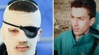  حکم آزادی عامل اسیدپاشی به داود روشنایی صادر شد 