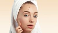 بهترین ترفند تخلیه جوش صورت بدون زخم و آسیب