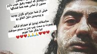 بازیگر جوان کشور دچار سانحه آتش سوزی شد + عکس