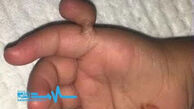 عمل جراحی شگفت آور روی دختر بچه 2 ساله!/عکس