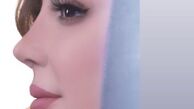 ظاهر جدید نیوشا ضیغمی پس از جراحی زیبایی + عکس
