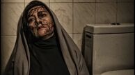 صورت چاقو خورده خانم بازیگر + عکس