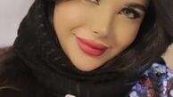 	جراحی زیبایی بینی با دکتر ضیغمی