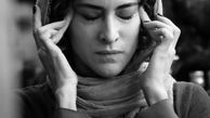 عکس عصبی ویشکا آسایش