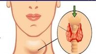 ۱۰ نشانه کار نکردن غده تیروئید + توضیحات