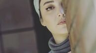 نیمه پنهان چهره روشنک گرامی + عکس