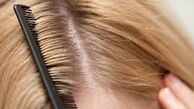 5 عادت اشتباهی که موهایتان را نابود می کند