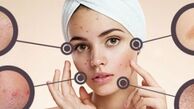 در چه مواردی باید به متخصص پوست مراجعه کنیم؟