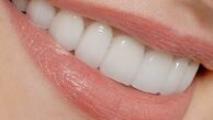 برای استحکام لثه‌ها پرتقال بخورید 