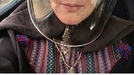 لاله اسکندی هم‌‌ کرونا گرفت + عکس