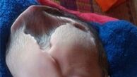 جمجمه این نوزاد نصفه است+تصاویر