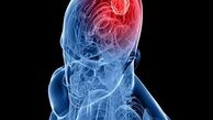 هوش مصنوعی تومور مغزی را ردیابی می کند