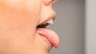 آیا خشکی دهان خطرناک است ؟ | بررسی علل ، نشانه ها و درمان های خشکی دهان