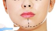 آرمیتا به علت ایست‌قلبی جان خود را از دست داد/ زنانی که اعتماد به نفس دارند کمتر جراحی زیبایی می‌کنند
