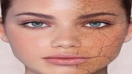 چگونه از خشک شدن «پوست» جلوگیری کنیم؟
