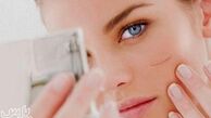 از بین بردن جای زخم و بخیه با روش های پزشکی و 22 روش گیاهی