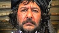 صورت زخمی شده امیرحسین صدیق + عکس