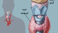 دلایل ایجاد مشکلات تیروئیدی در بدن