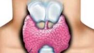 علت عصبانیت، ناراحتی و عدم تمرکز ناشی از چیست؟