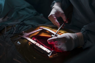 Gentle-Violence-The-Heart-Memories-from-the-darkness-of-our-bodies5__880