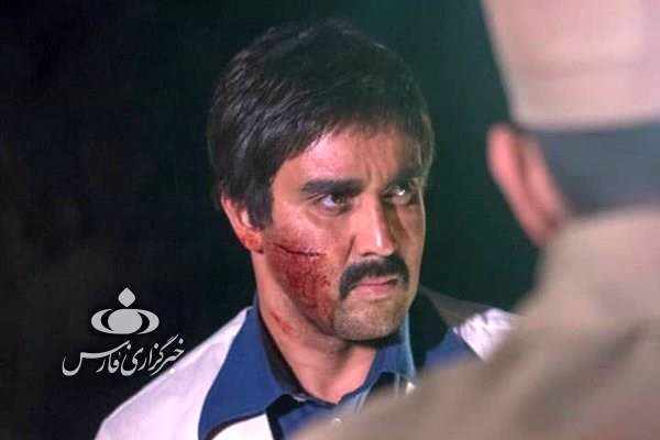 صورت پوریا پورسرخ زخم شد + عکس