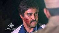 صورت پوریا پورسرخ زخم شد + عکس