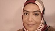 ساناز سماواتی با ابروی پیوندی + عکس