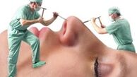 هشدار وزارت بهداشت درباره کلینیک‌های زیبایی غیرقانونی