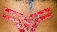 خالکوبی‌های چندش‌آور /تصاویر