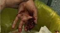 جوان 20 ساله بر اثر جراحات در گذشت